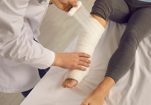 Broken Bones Injury Attorney, Providence, RI